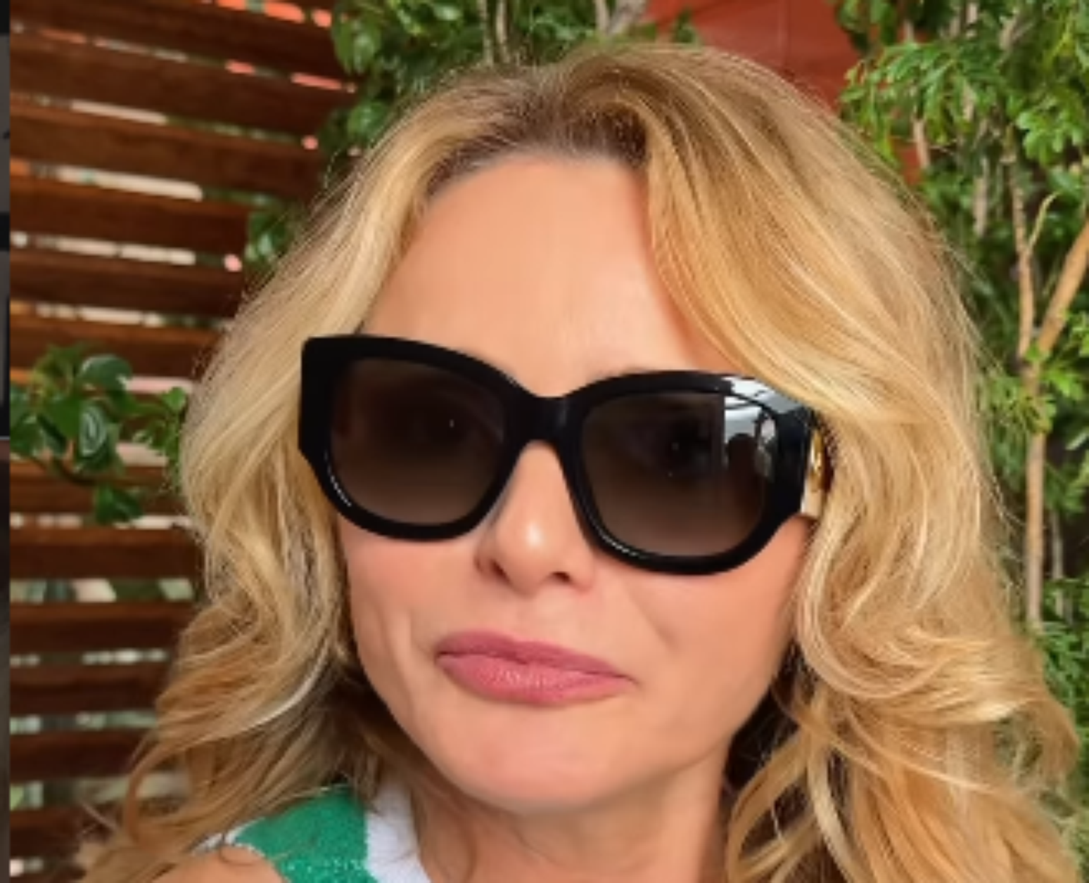 Rita Guedes usa óculos escuros após complicação cirúrgica