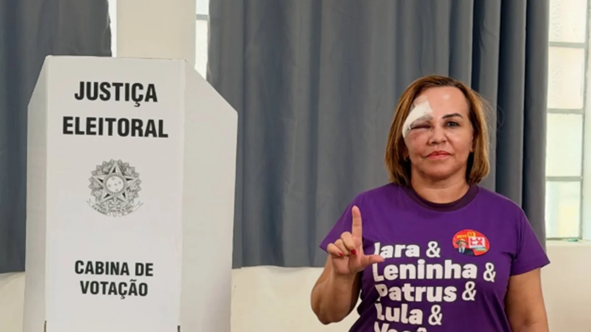 Vereadora do PT ferida com tijolada vota em MG: "Meu voto carrega coragem"